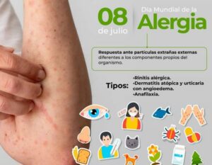 Día Mundial de la alergia: un llamado a la prevención y la empatía